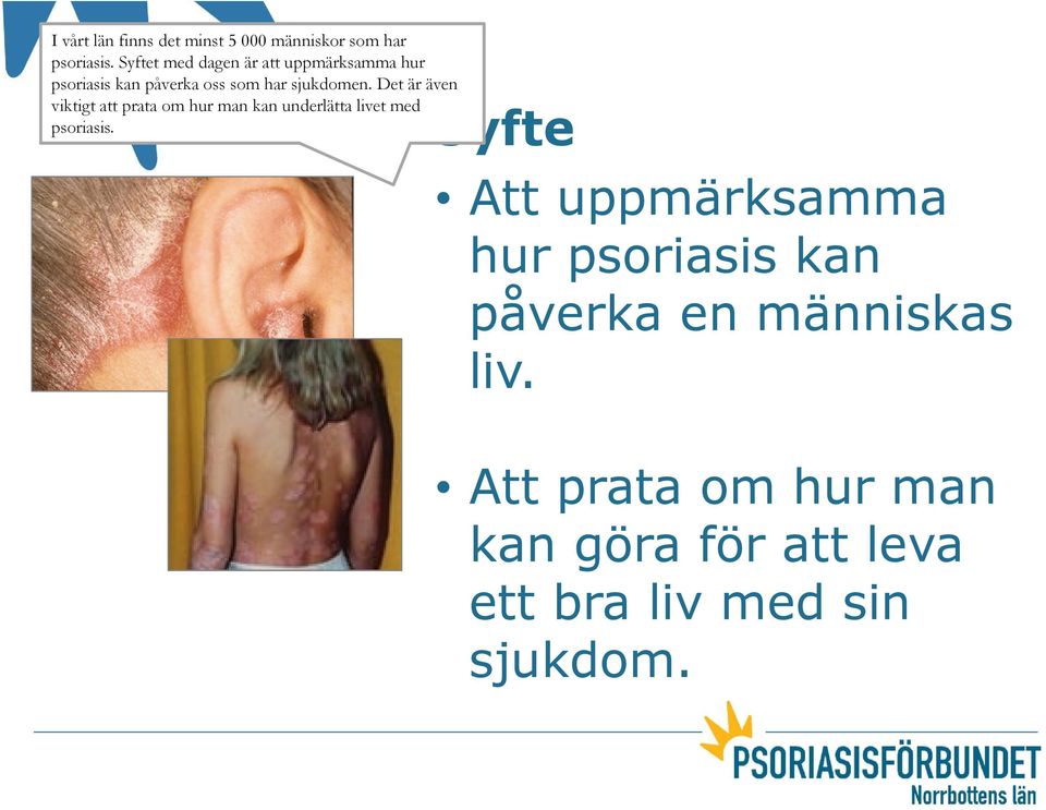 Det är även viktigt att prata om hur man kan underlätta livet med psoriasis.