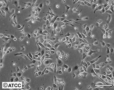 Biotester Modifierade humana celler som reagerar på toxiska ämnen Agneta Oskarssons forskargrupp på SLU Tester