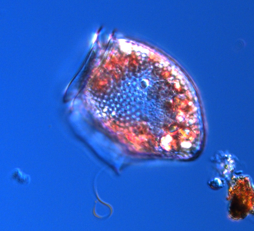Dinoflagellaten Dinophysis norvegica* kan producera diarrégifter som,