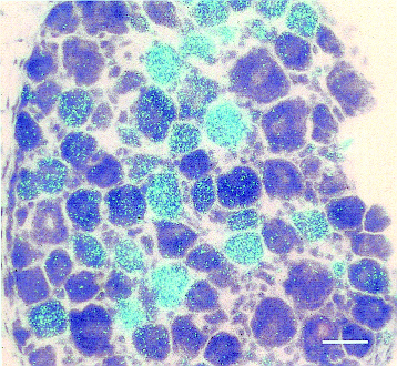 Figur 3. Bilden visar laterala hypotalamus efter dubbelfärgning med antikroppar mot orexin (rött) och NPY (grön).