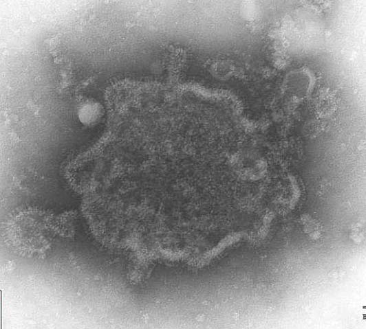 INTRODUKTION Bovint respiratoriskt syncytialt virus och sjukdomen det orsakar Etiologi Bovint respiratoriskt syncytialt virus (BRSV) tillhör tillsammans med bland annat Humant respiratoriskt