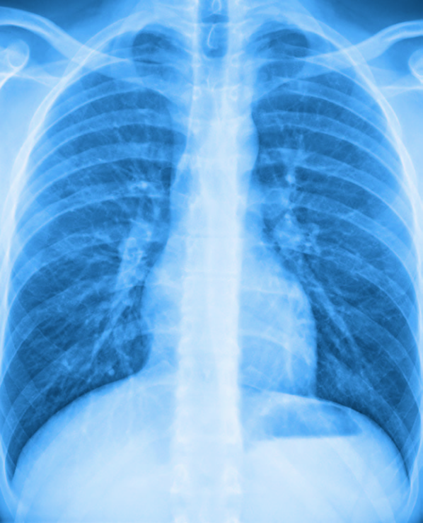 Genom våra lungor passerar varje dag 25.000 liter luft. Ju renare luften är, desto mer ökar välbefinnandet.