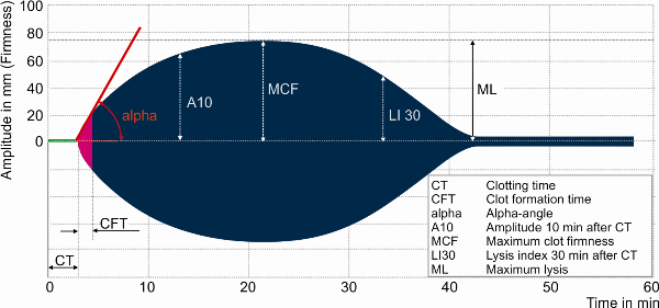 Schematiska kurvor Parameter TEG ROTEM Koagulationstid R CT