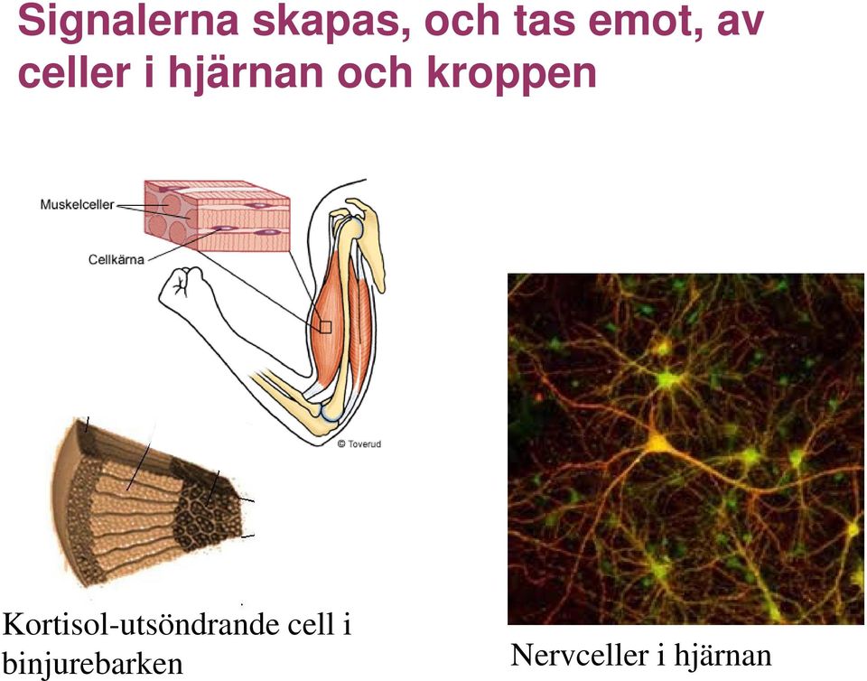 kroppen Kortisol-utsöndrande