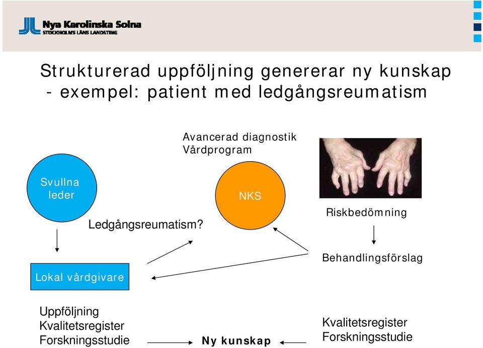 Ledgångsreumatism?