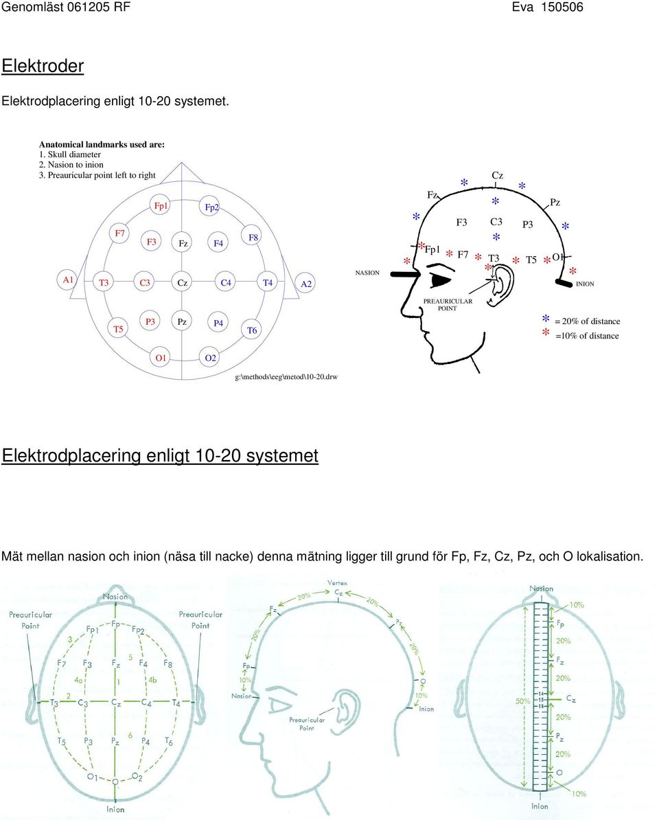 P3 Pz P4 T6 PREAURICULAR POINT = 20% of distance =10% of distance O1 O2 g:\methods\eeg\metod\10-20.