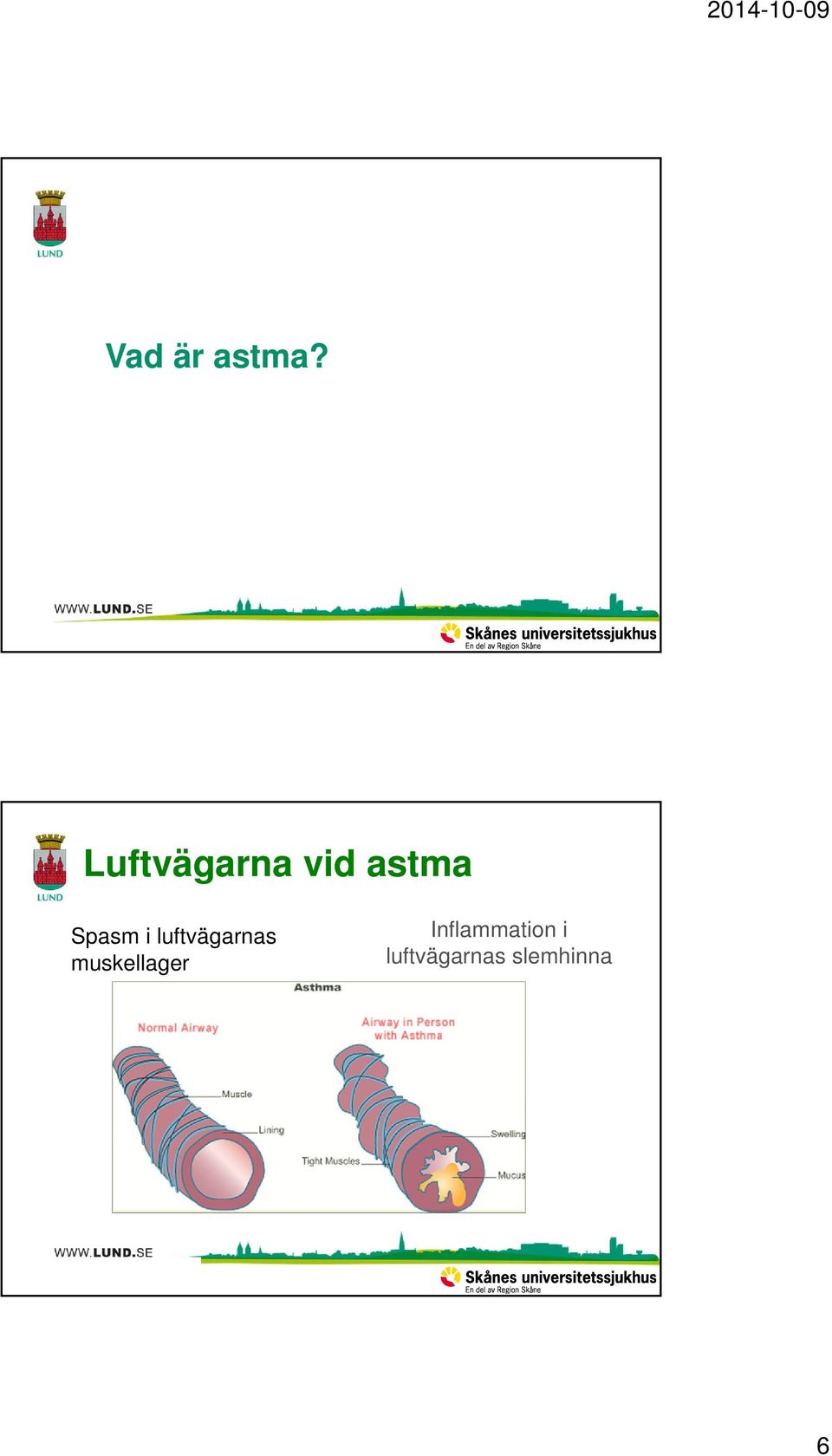 Spasm i luftvägarnas