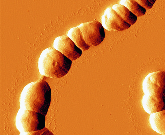 Figur 1. Streptococcus pneumoniae (pneumokocker), som är bland de vanligaste luftvägsbakterierna, bildar karakteristiska kedjor som ett resultat av sin tillväxt.
