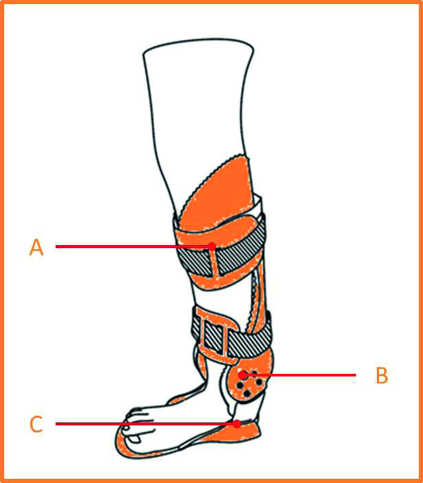 LH (Lateral Hinge) MH (Medial Hinge) 7 SKÖTSEL OCH UNDERHÅLL, MONTERING OCH ÅTERMONTERING Ortosen alla delar är modulerbara. (A. Skenbensskal, B. Gångjärnssystem, C.