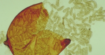 Nematodens biologi Aspekter på sjukdomsutvecklingen. Nematoderna förblir livskraftiga inuti cystorna. Dessa är av ett knappnålshuvuds storlek och innehåller upptill 300 ägg och larver (fig. 6).