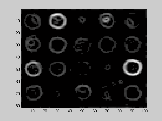 Bilaga 1 Bilden visar watershedpixlarna som erhållits efter att gradienten av ursprungsbilden beräknats.