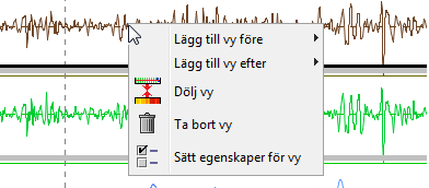 5.3 Plotdiagram Plotdiagram används för att visa mätparametrar som varierar längs spåret, exemplet här ovan visar hur höjdläget varierar längs med spåret.