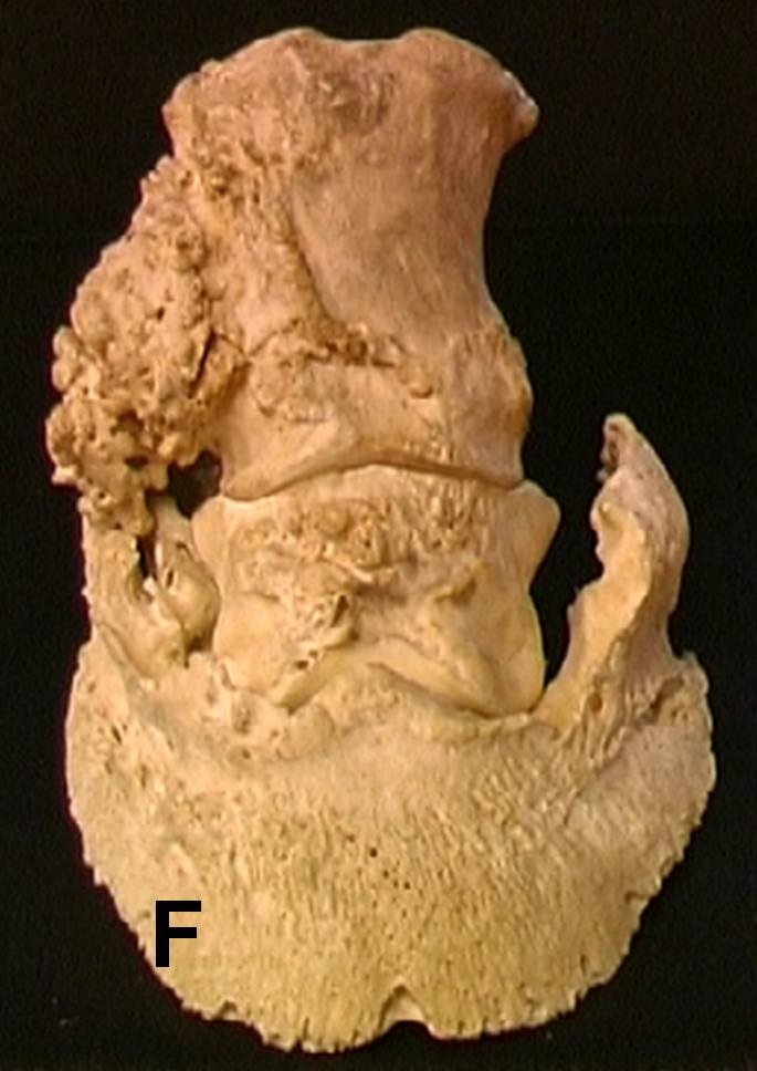 Figur 2. Hovbroskförbening av olika grader A: Ingen hovbroskförbening. B: Lindrig hovbroskförbening. C: Måttlig hovbrokförbening. D: Kraftig hovbroskförbening.