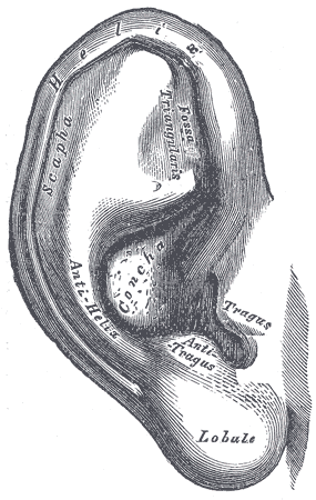 1.6.6 Ytteröredeformiteter Ytterörat består av öronmusslan (se figur 1) och hörselgången fram till trumhinnan.
