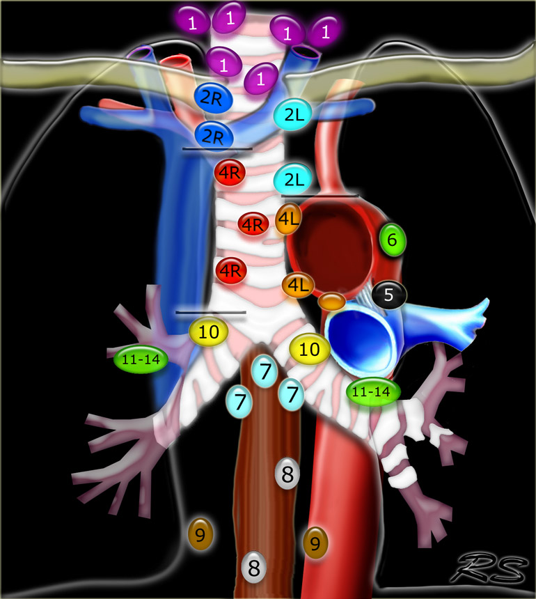 IASLC Lymph