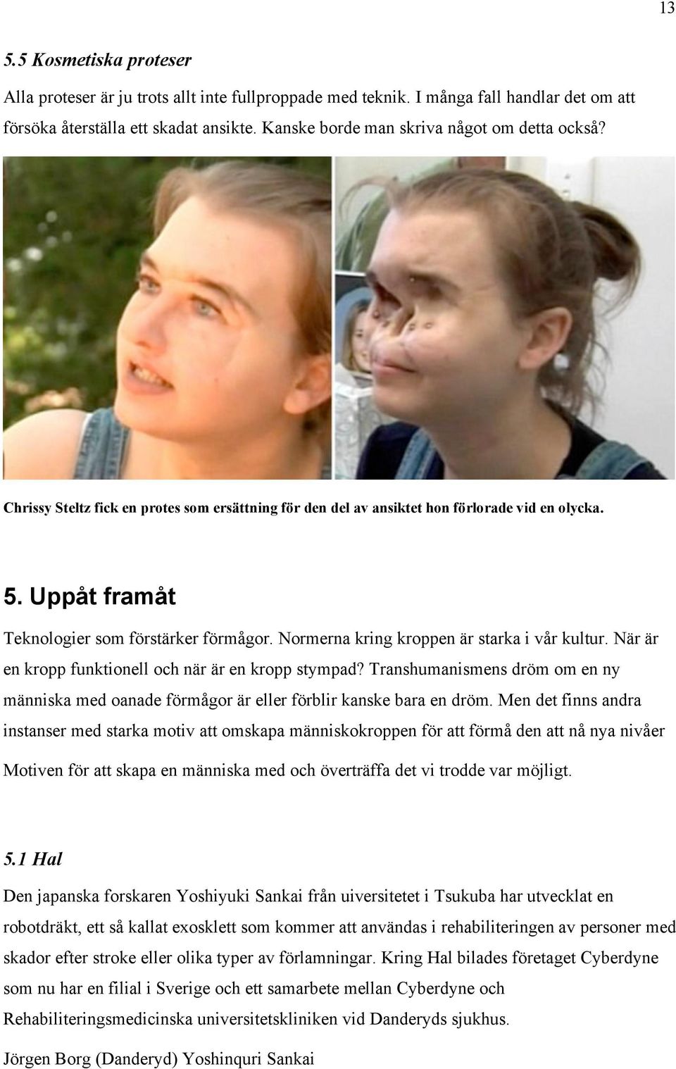 Normerna kring kroppen är starka i vår kultur. När är en kropp funktionell och när är en kropp stympad?
