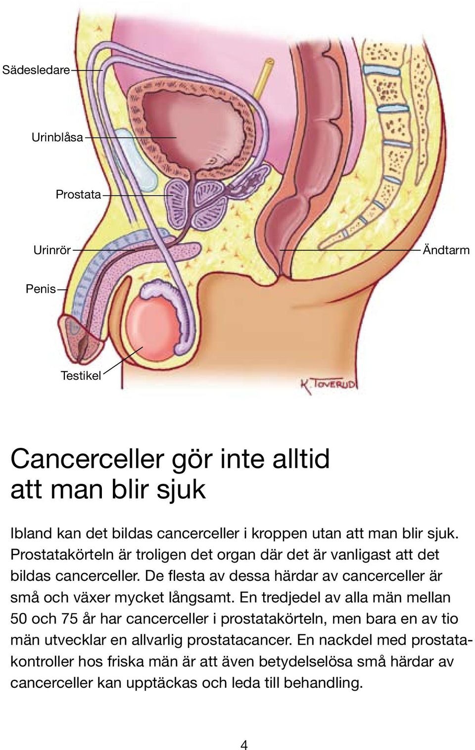 De flesta av dessa härdar av cancerceller är små och växer mycket långsamt.