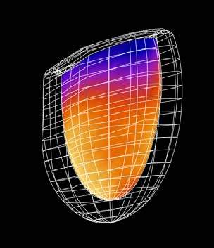 Gated SPECT Michael Ljungberg/Medical Radiation Physics/Clinical Sciences Lund/Lund University/Sweden 37