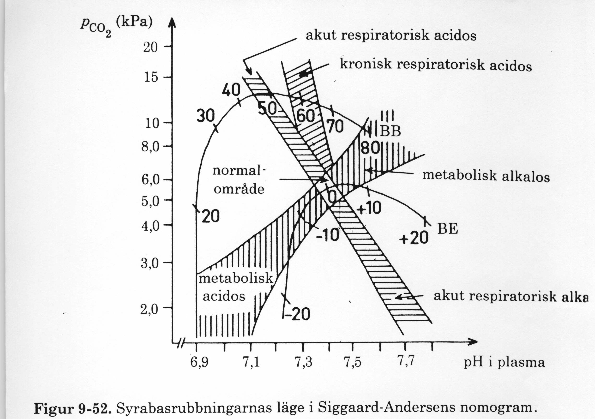 "Fälten" i SA kurvnomogram, när man redan känner till ph och pco 2 x Acid Base Online Tutorial, Univ Connecticut http://fitsweb.uchc.edu/student/selectives/timurgraham/welcome.