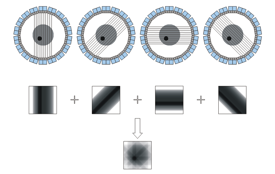 Time-of-flight vs conventional PET Data collection and reconstruction in a conventional PET scanner.