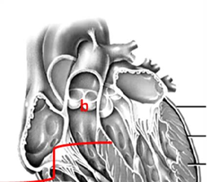 16. Vad kallas det utrymme mellan lungorna som hjärtat ligger i? 0.5p mediastinum 17.