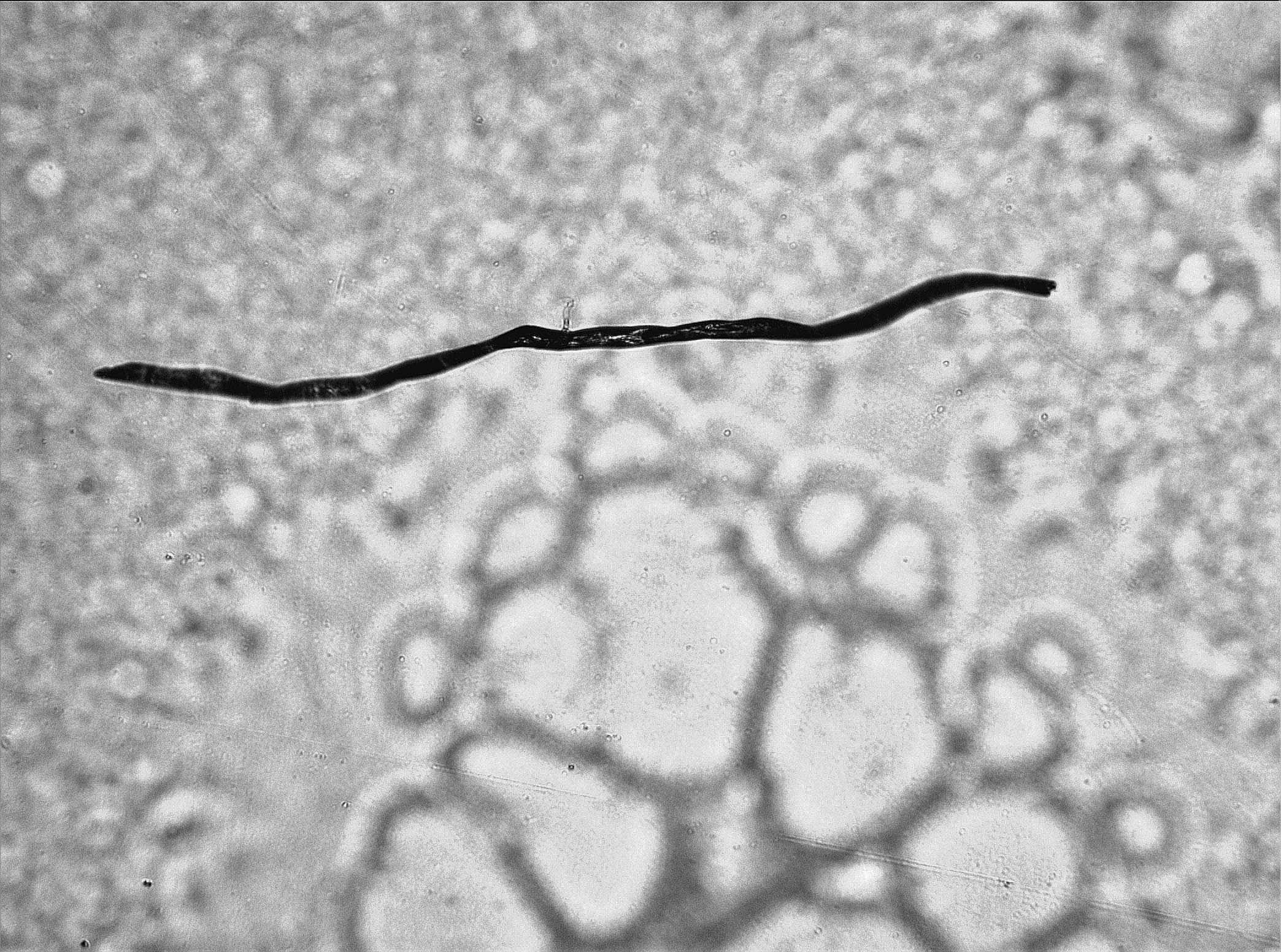 Plack Syncytium Oinfekterad cellmosaik Falsk
