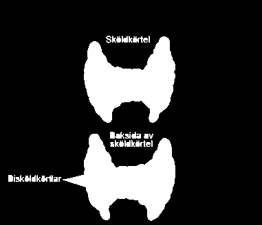 Årsrapport 2015 19 Frekvensen blödning och infektion efter thyroideakirurgi är således i Sverige 0.4 respektive 0.8 %.