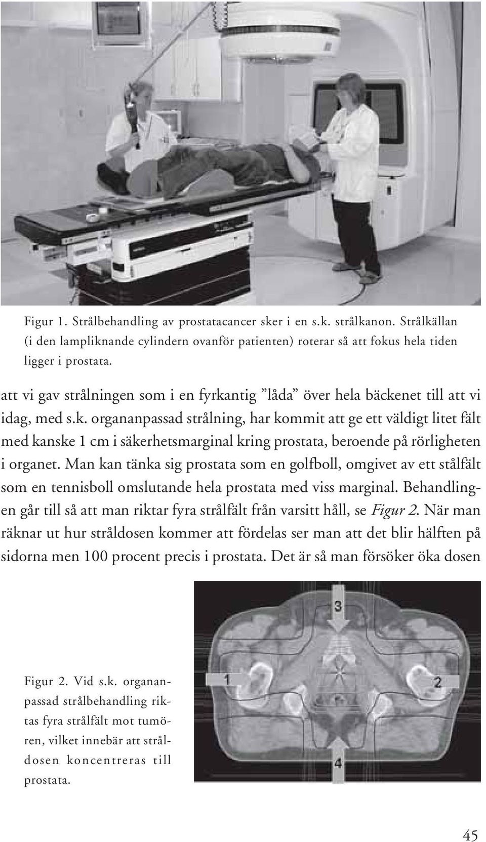 Man kan tänka sig prostata som en golfboll, omgivet av ett stålfält som en tennisboll omslutande hela prostata med viss marginal.