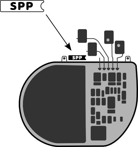 8.6. PACEMAKER-ID Pacemakern kan frågas av och programmeras via telemetri genom att programmeringshuvudet kopplas till en speciell programmerare vid Sorin CRM.