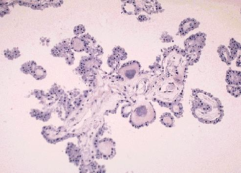 c) Medulla oblongata (semisnitt) Makroskopisk analys: Preparatet utgör ett tvärsnitt genom mitten av hjärnstammen i höjd med oliven. Endast en halva är medtagen.