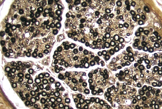 N4 Perifer nerv OsO4 Tvärsnitt: Osmiumimpregneringen färgar fettet i fettceller och myelinskidor svart. Preparatet visar flera tvärskurna nervbuntar.