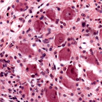 N9 Spinalganglion Bindvävskapsel Nervecellskroppar Cellkärna Nukleol Satellite cell Axonbunt N10 Sympatiskt ganglion Htx-eosin En del av ett ganglion ses omgivet av en bindvävskapsel (se bild på