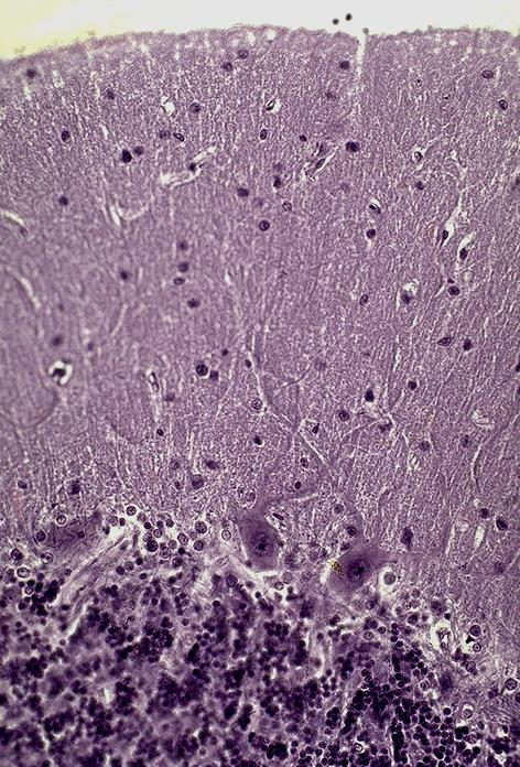 b) Cortex cerebelli Makroskopisk analys: Visar den klassiska bilden av det s.k. livsträdet (arbor vitae).