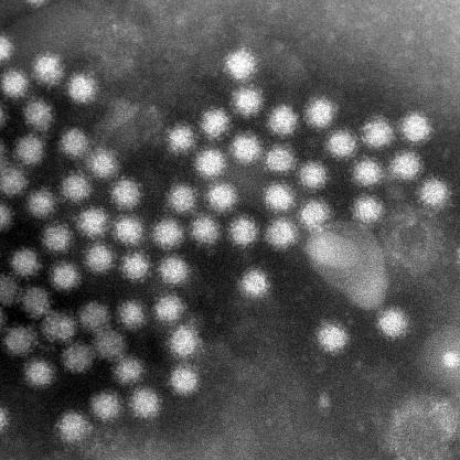 Bakgrund Norovirus är en vanlig orsak till gastroenterit världen över. Norovirus kan spridas via kontaminerat vatten. Finns olika genogrupper, svårt att odla. Norovirus, elektronmikroskop.