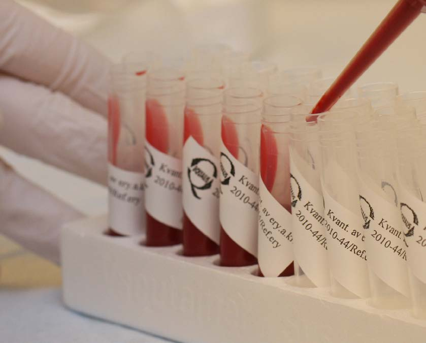 Exempel på provmaterial Blod, plasma, urin, cerebrospinalvätska Bakteriekulturer Cellpreparat