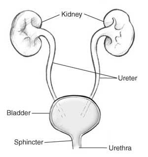 Urinvägsdilatation Reflux gr III-V Pelvoureteral stenos (PUS) Distal uretärstenos (DUS) Primär