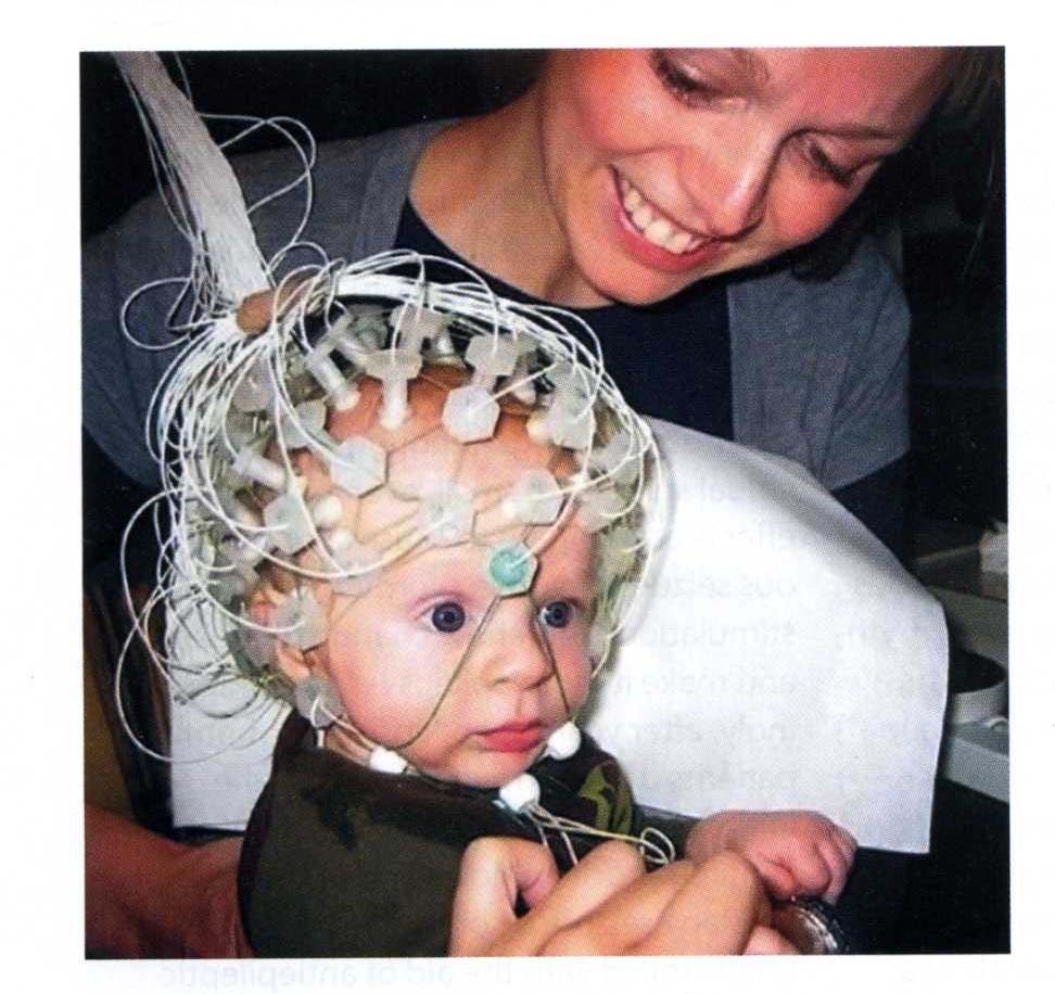 EEG (elektro-encefalogram) I detta exempel studeras EP (evoked