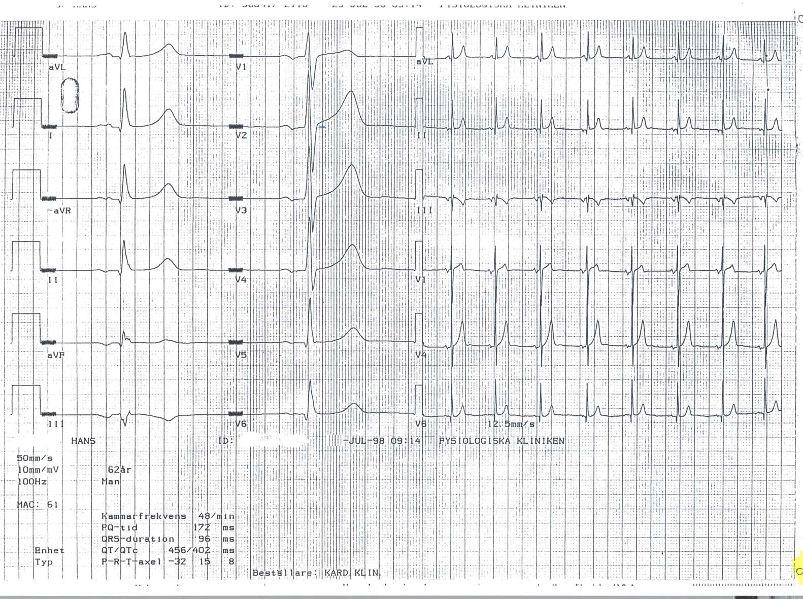 EKG 21