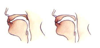 Nasala icke nasala Skillnaden mellan