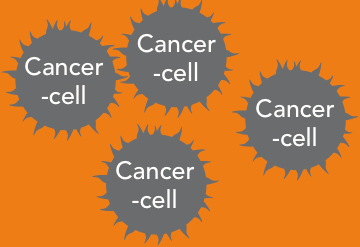 Tumörassocierade makrofager (TAM) så fungerar det Tumörceller utnyttjar makrofager som skydd BioInvent utvecklar