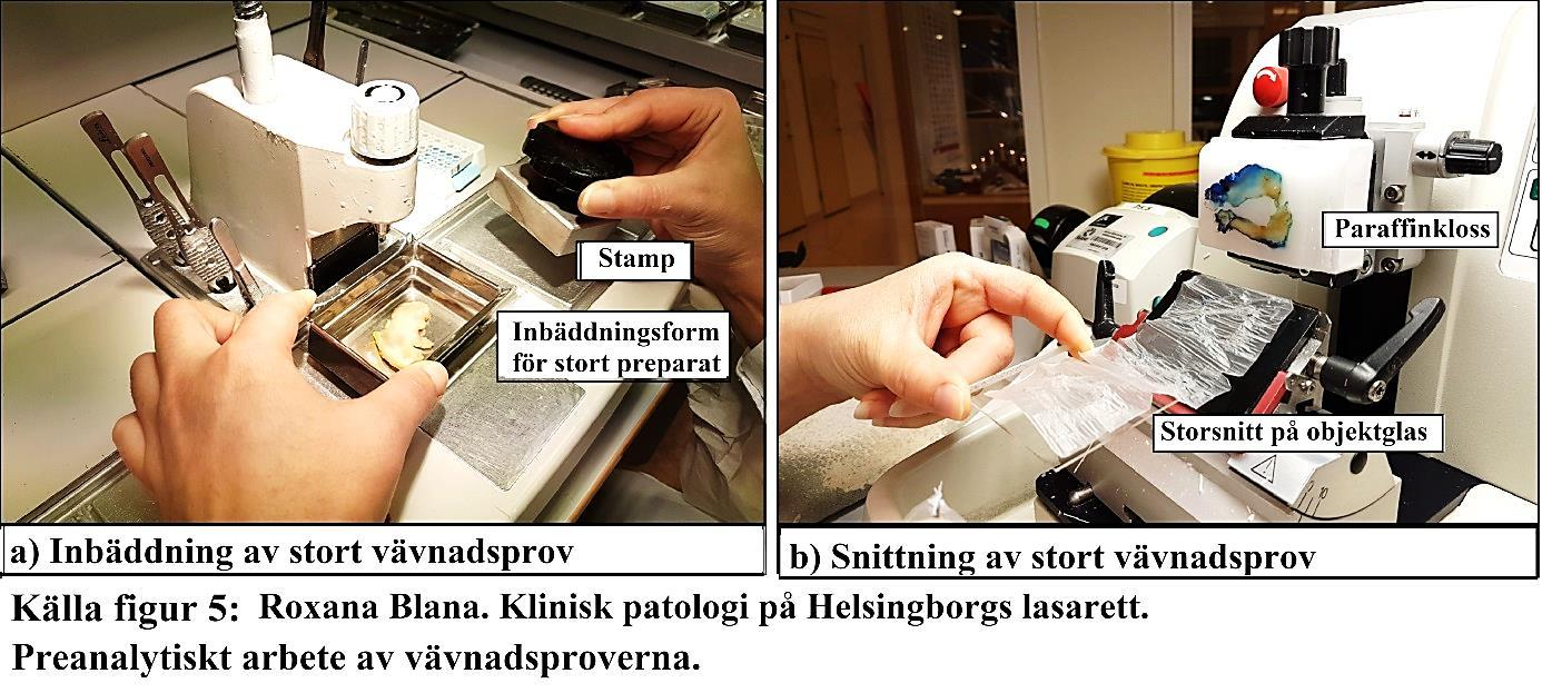Efter fixering, kördes testproverna i det nya programmet i LOGOS B för dehydrering av storpreparat (Nytt SS-program) med den nya Histo-Clear som intermedium.