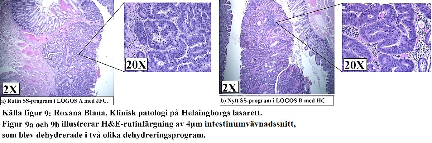 Vidare sammanfattades utvärdering av objektglasen som färgades med immunhistokemiska metoder i Tabell 3b.