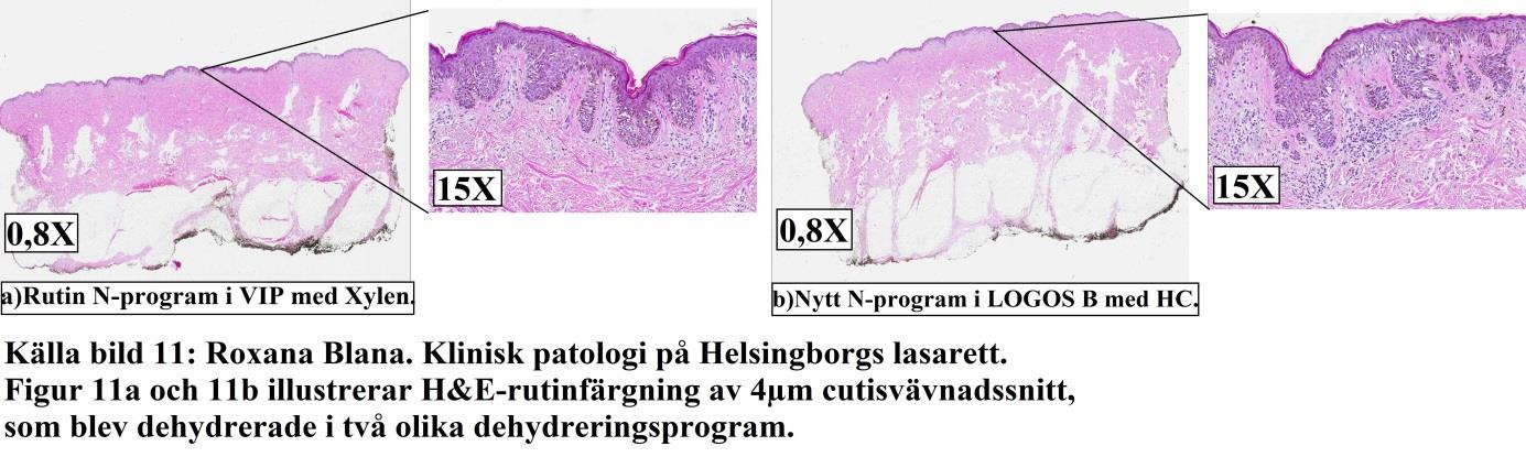 3.4. Validering av små fettrika vävnadsprover Samtliga resultat bedömda av patologerna sammanställs i Tabell 4a.