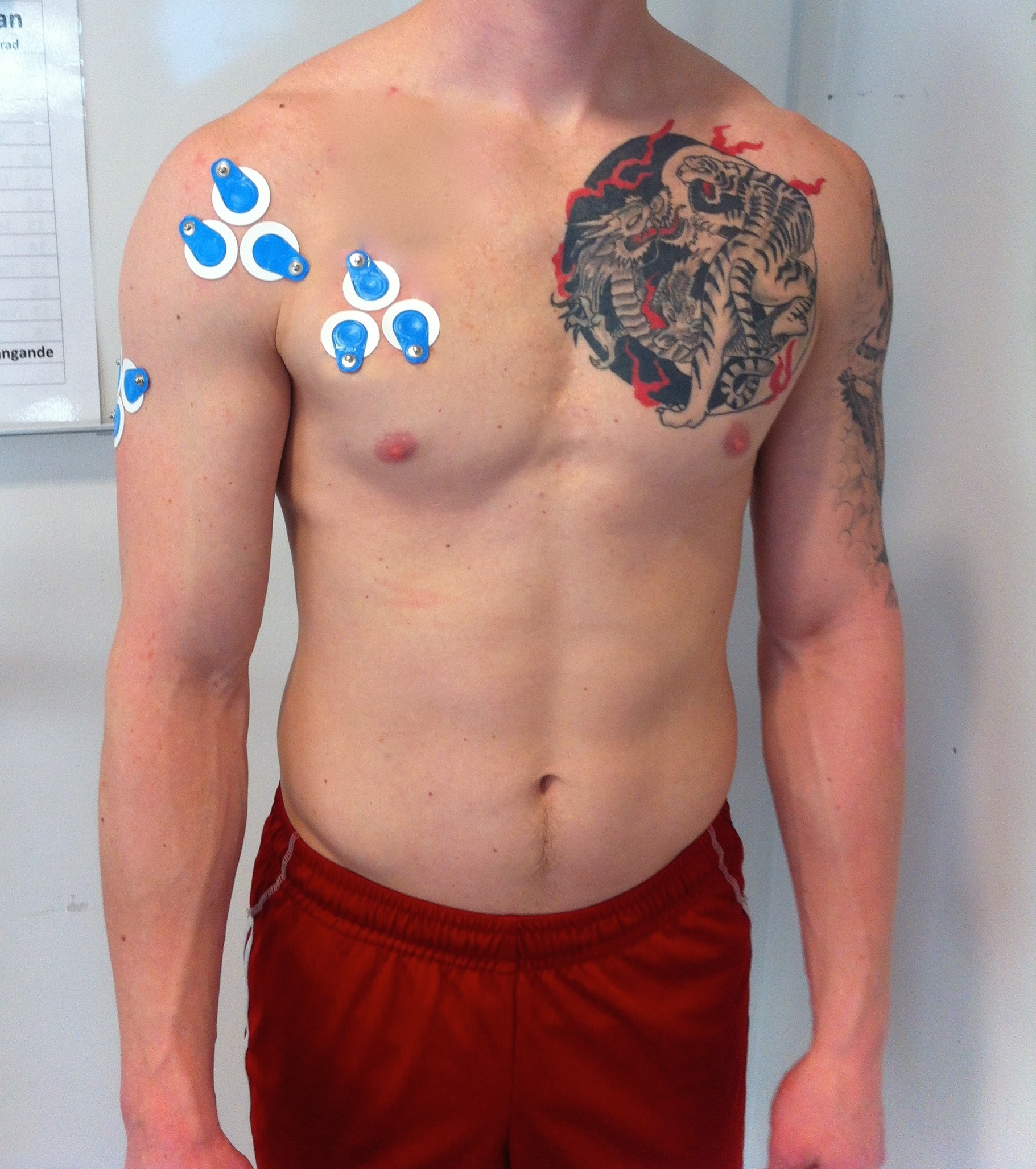 Figur 2: Utplacering av elektroder för elektromyografi på pectoralis major, främre deltoideus, triceps brachii.