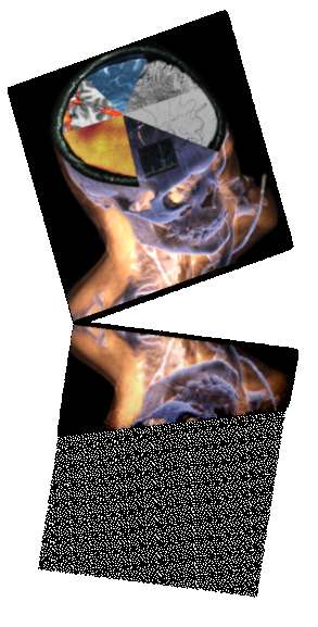 CT Bildrekonstruktion