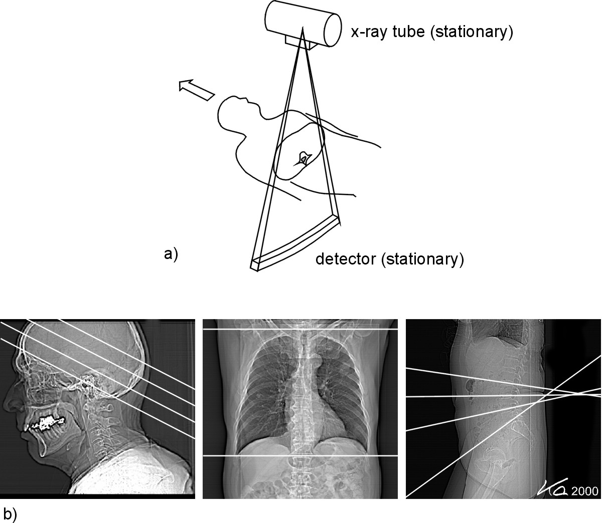 Bildtagning Översiktsbild Sekvens scan