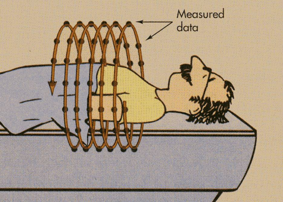 Spiral CT Föreslogs av Willi Kalender 1989. Slip rings för kontinuerlig gantryrotation.