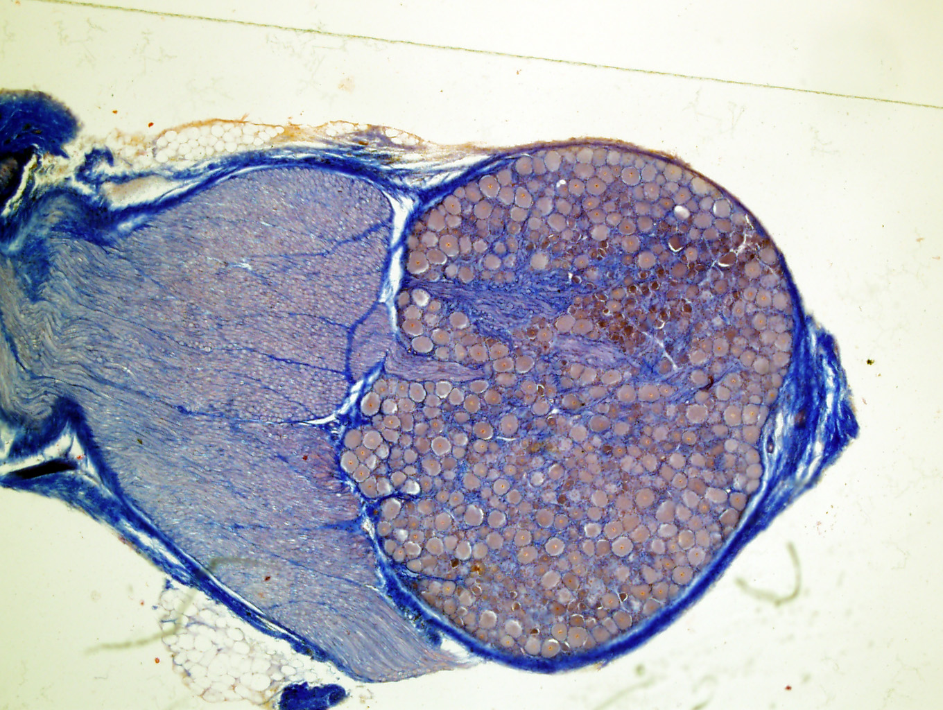 19) Bilden ovan visar ett sympatiskt ganglion med en grupp stora cellkroppar till höger och nervfibrer till vänster i bilden.
