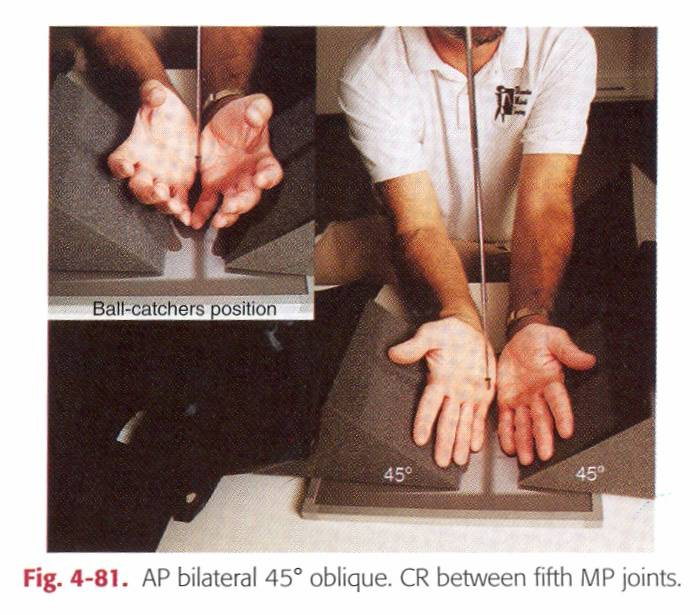 HAND - inåtvridning Patienten sittande, sidan mot undersökningsbordet, böjd armbåge. Handen inåtroteras 45 o från PAinställningen (Använd snedkudde!) alt.