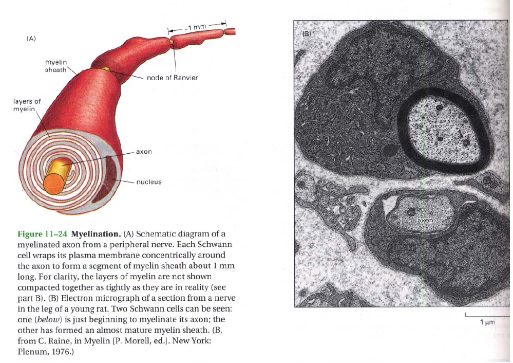 Myelinesering av nervtrådar Myelinesering av nervtråden ökar dramabskt propagabons- hasbgheten av nersignaler MulBpel scleros är